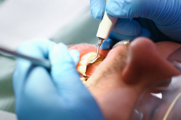 Best Emergency Denture Repair in San Juan, TX