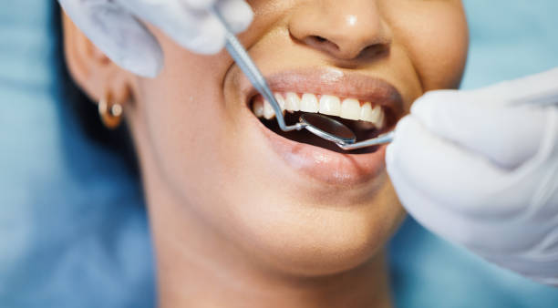 Best Emergency Wisdom Tooth Extraction in San Juan, TX